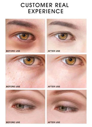 Крем вокруг глаз artiscare golden repair eye cream +золото6 фото