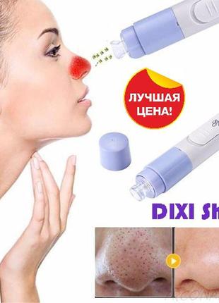 Spot cleaner utm вакуумний очищувач пір шкіри обличчя