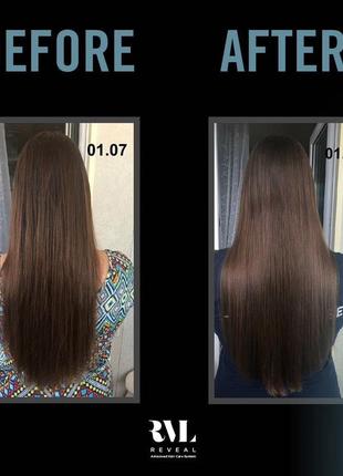 Система вирощування волосся від jeunesse3 фото