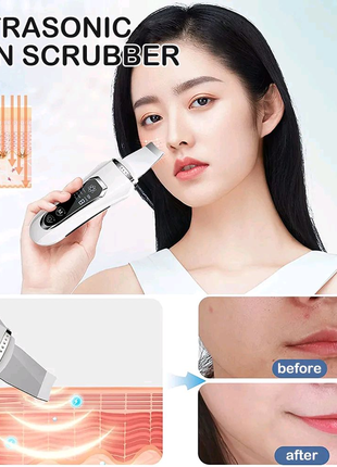 Ультразвуковий скрабер для обличчя ultrasonic facial beauty devic2 фото