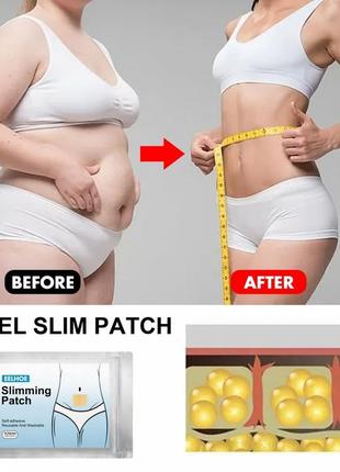 Пластыри для похудения, детоксикация. slimming patch6 фото
