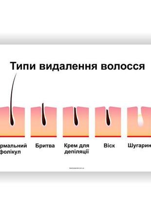 Плакат типи видалення волосся vivay 84х118 см білий z115-2024