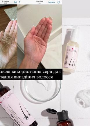 Набор «4 в 1 для роста и против выпадения волос» nani beauty2 фото