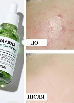 Medi-peel aha bha amino cica-nol b5 ampoule відновлювальна сироватка для шкіри обличчя2 фото