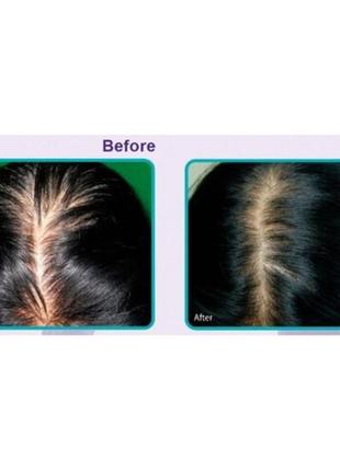 Регенерувальна емульсія для шкіри голови проти випадіння волос...3 фото