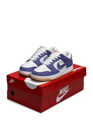 feet hurting in ladies nike shox women shoes