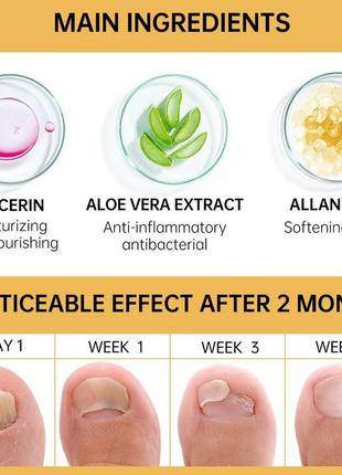 Лечение грибка ногтей, сыворотка противоинфекционное паронихия онихомикоз ремонт геля для ногтей ног средства по уходу за ногами5 фото