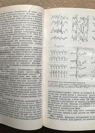 Функциональная диагностика нервных болезней. л.р. зенков м.а. ронкин4 фото