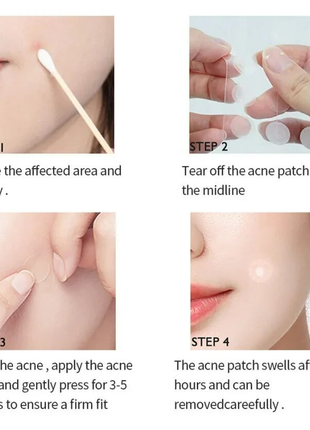 Патчі від прищів висипань (анті-акне) acne patch - 72шт/упаковка2 фото