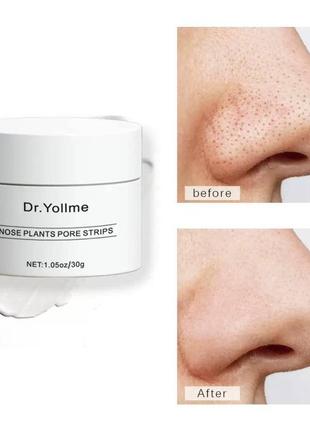 🌟 маска для обличчя від чорних цяток dr.yollme (30 грам + 40 серветок) 🌟