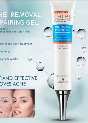 Гель против акне быстрого действия