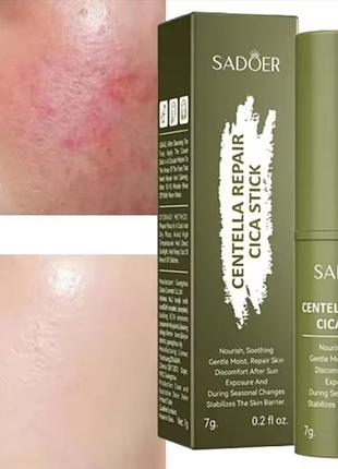 Бальзам стик карандаш от покраснения кожи прыщей сухости увлажняет защищает восстанавливает