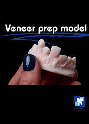 Модель для препарування під вініри | veneer prep model