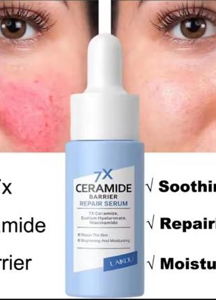 7х успокаивающая сыворотка для покраснения лица, лечение розацеа, улучшение чувствительного барьера кожи, восстанавливающая с керамидами