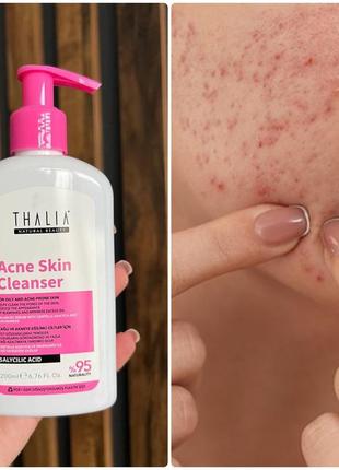 Гель для вмивання з саліциловою кислотою від прищів акне висипань thalia туреччина