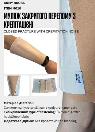 Муляж закритого перелому з крепітацією