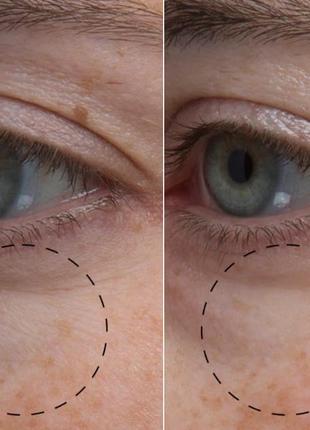 Сыворотка-крем для восстановления кожи вокруг глаз philosophy hope eye cream