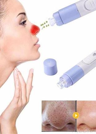 Вакуумный очиститель spotcleaner face pore cleaner вакуумный очиститель пор лица
