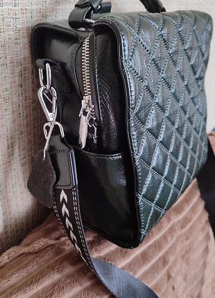 Сумка-рюкзак сумочка шкіра темно-зелена, як нова, якісна фурнітура