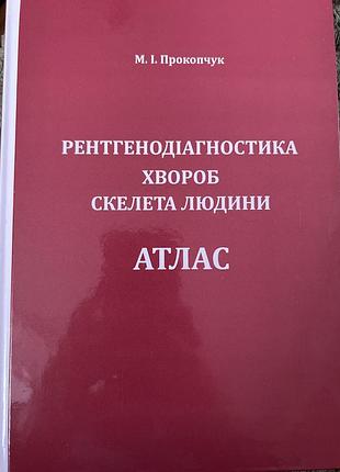 Атлас рентгенодіагностика хвороб скелета людини