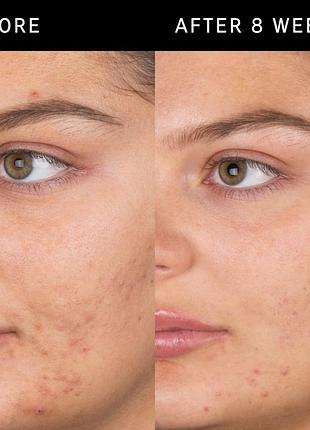 Очисний засіб із саліциловою кислотою the inkey list salicylic acid cleanser