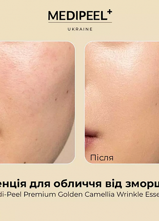 Антивозрастная эссенция для лица medi peel peptide 9 golden camellia wrinkle essence 50ml2 фото