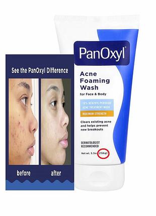 156 гр panoxyl очищающая пенка акне лица тела максимальная эффективность foaming acne wash pxl-22855