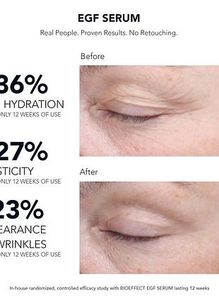 Сироватка проти старіння шкіри обличчя bioeffect egf serum