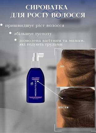 Найкраща ціна! сиворотка для росту волос mediceuticals