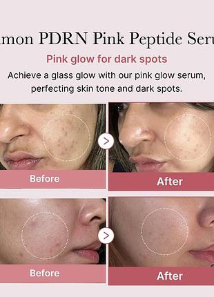 Відновлювальна антивікова сироватка для обличчя з пептидами medicube pdrn pink peptide serum3 фото