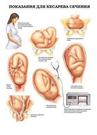 Плакат а3. показання дляєвого перерізу