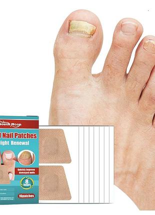 Пластир-наклейки для корекції врослого нігтя nail patches в упаковці 16 шт