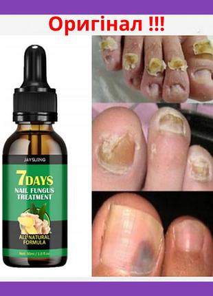 Відновлюючий засіб для лікування грибка нігтів, проти інфекції jaysing nail fungus trea 30ml