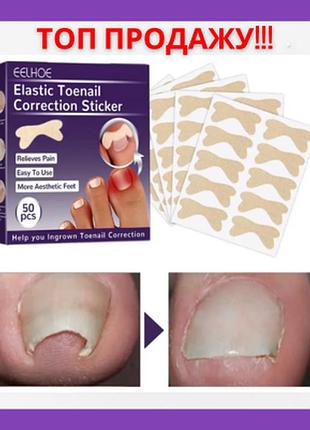 Наклейки коректори eelhoe від вростання та для корекції нігтів на ногах 50 шт