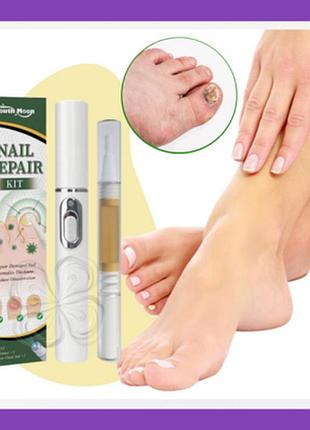 South moon nail repair kit - натуральный препарат от грибка ногтей