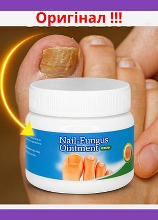 Ефективний швидкодійний крем-гель для лікування грибка нігтів трав'яний екстракт nail fungus ointment 30ml