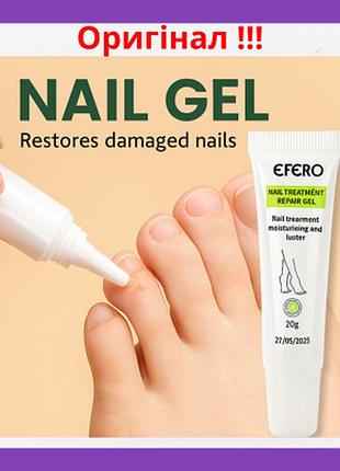Ефективний відновлюючийр кем-гель для лікування грибка нігтівта ніг проти інфекції nail treatment repair gel 20g