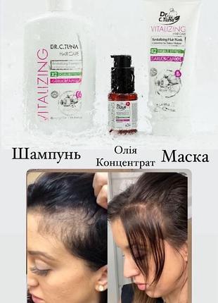 Набір для волосся проти випадіння farmasi + подарунок 🎁