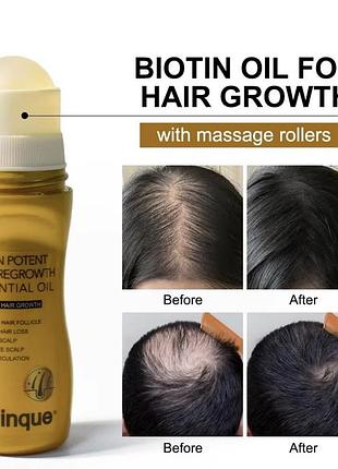 Биотин эссенция для роста волос нова