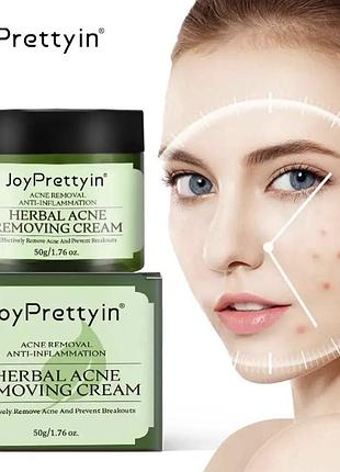 Крем від акне від прищів новий