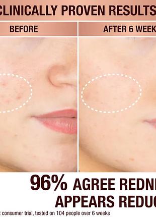 Сыворотка для коррекции темных пятен charlotte tilbury dark spot correcting radiance recov...