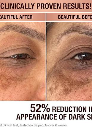 Сыворотка для коррекции темных пятен charlotte tilbury dark spot correcting radiance recov...