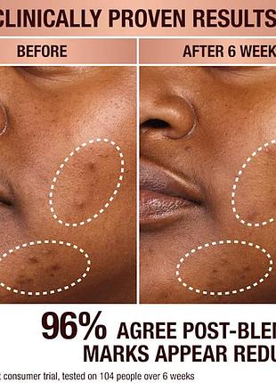 Сыворотка для коррекции темных пятен charlotte tilbury dark spot correcting radiance recov...