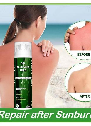 gel corporal aloe vera puro atlantia, 200 ,     870                    |  #189841126