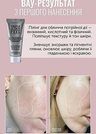 Кислотний пілінг від instytutum