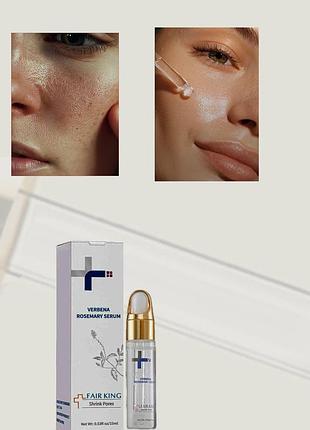Сыворотка для сужения пор fair king