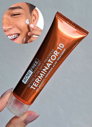Крем для точкового лікування акне acne free terminator 10 acne spot treatment 10% benzoyl peroxide 30 мл