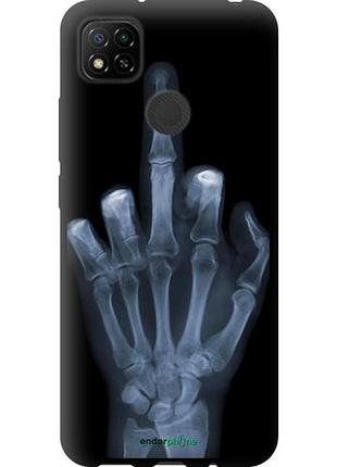 Чохол tpu на full silicone case для xiaomi redmi 9c рука через рентген