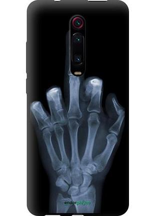 Чохол tpu на xiaomi redmi k20 рука через рентген