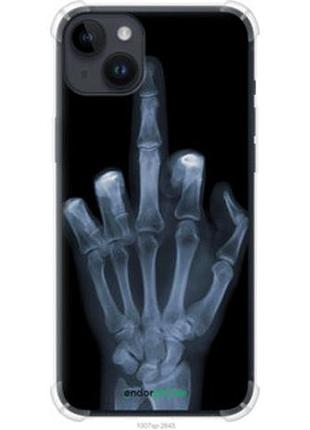 Чохол на iphone 14 plus рука через рентген "1007sp-2645-7673"